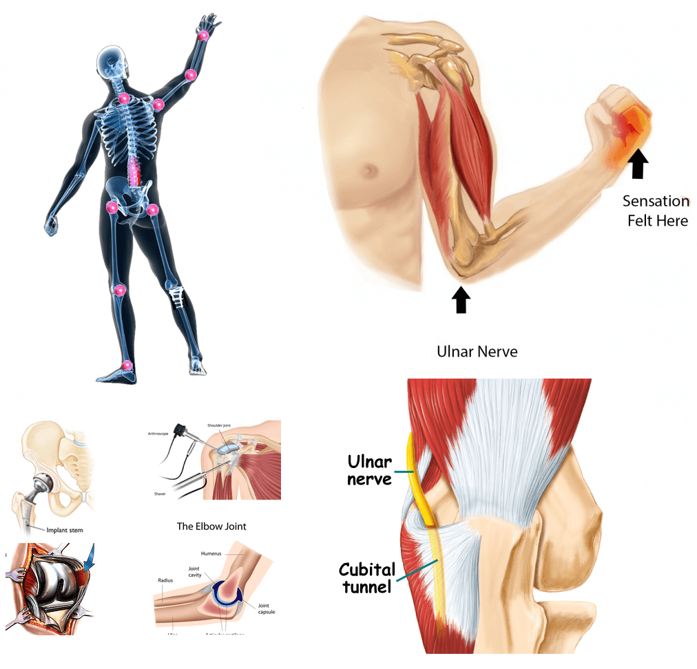 Our bones support us and allow us to move