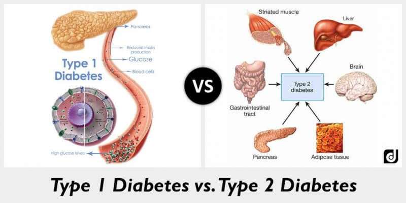 What is diabetes?