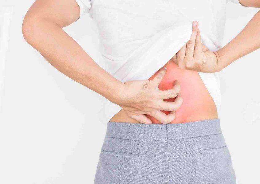 How to overcome an allergy?