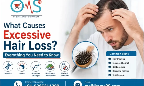 What Causes Excessive Hair Loss? Everything You Need to Know – Common causes, symptoms, and hair care tips for healthier hair.