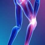 Buy Joint pain medicine online