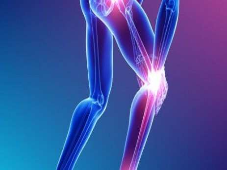 What is a Good Supplement for Joint Pain?