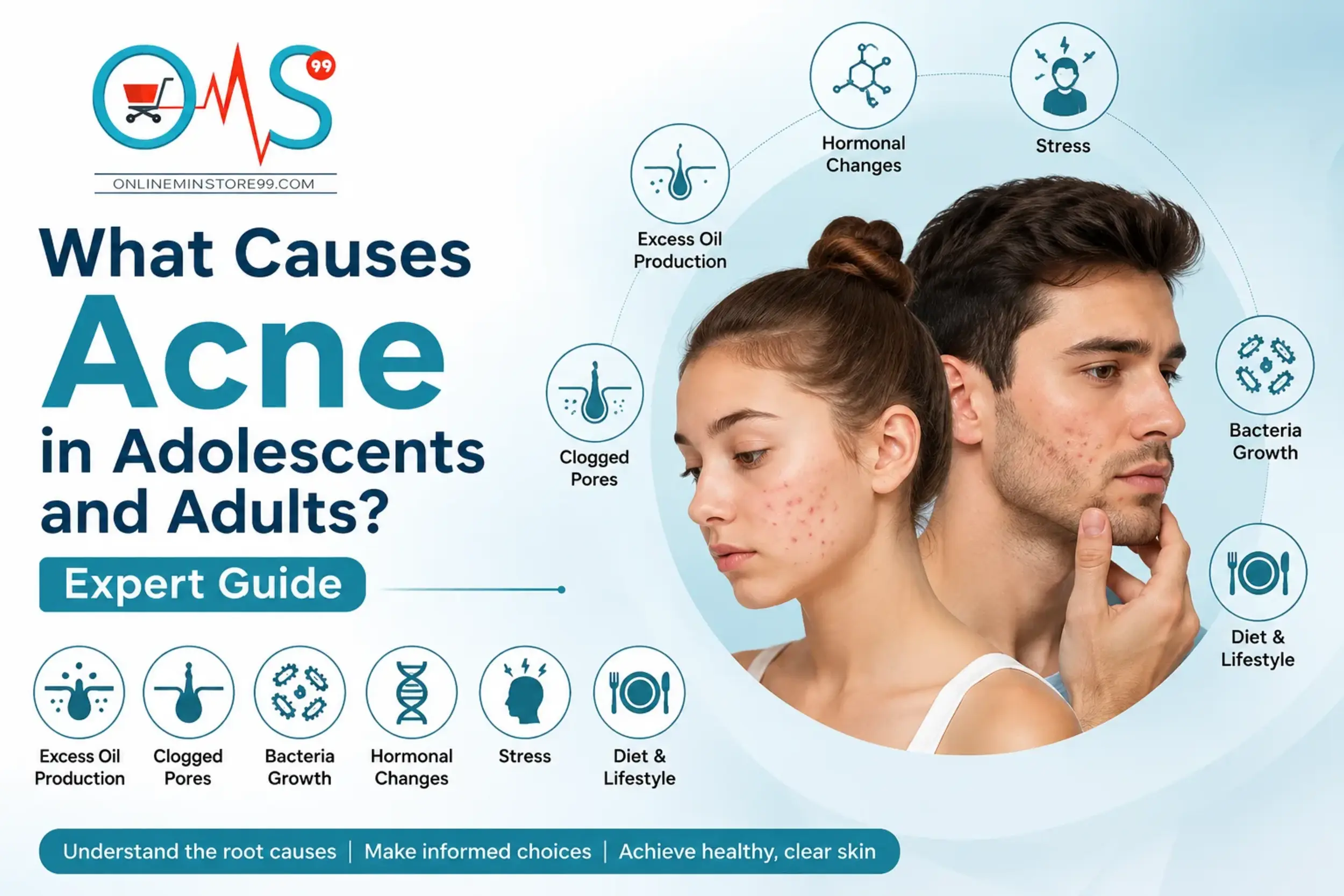 What Causes Acne in Adolescents and Adults? Expert Guide