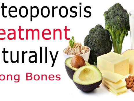 You can keep bones healthy and Osteoporosis treatment by best 7 foods