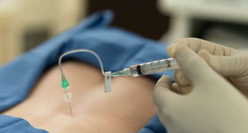 Should You Try Injections To Pain Reliever?