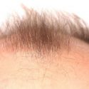 About-Hair-Loss