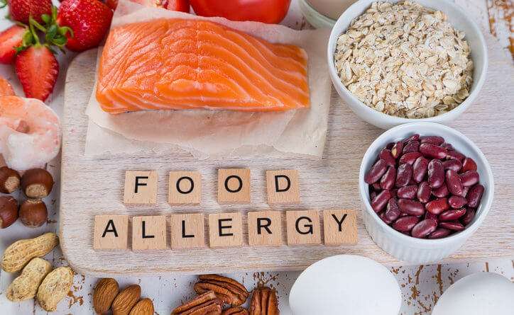Some of the food allergies