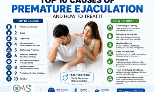 Top 10 causes of premature ejaculation and treatment options infographic showing common triggers, medical factors, lifestyle causes, and effective treatment methods by OMS99.